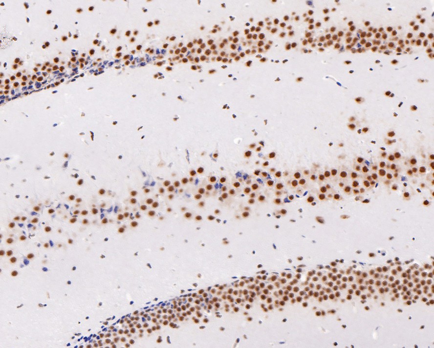 Immunohistochemical analysis of paraffin-embedded mouse hippocampus tissue with Rabbit anti-DDX5 antibody (ET1705-32) at 1/2,000 dilution.<br />
<br />
The section was pre-treated using heat mediated antigen retrieval with sodium citrate buffer (pH 6.0) for 2 minutes. The tissues were blocked in 1% BSA for 20 minutes at room temperature, washed with ddH2O and PBS, and then probed with the primary antibody (ET1705-32) at 1/2,000 dilution for 1 hour at room temperature. The detection was performed using an HRP conjugated compact polymer system. DAB was used as the chromogen. Tissues were counterstained with hematoxylin and mounted with DPX.