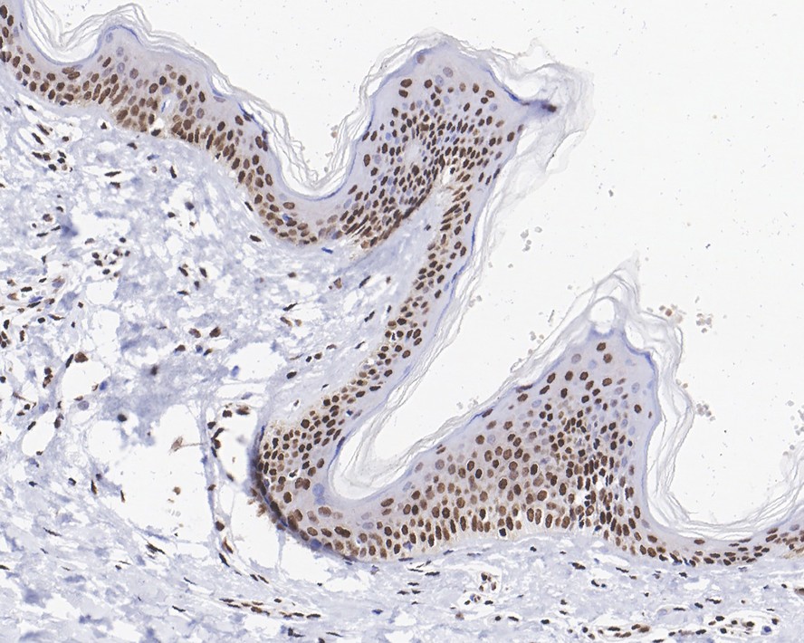 Immunohistochemical analysis of paraffin-embedded human skin tissue with Rabbit anti-Histone H3(acetyl K56) antibody (ET1608-9) at 1/200 dilution.<br />
<br />
The section was pre-treated using heat mediated antigen retrieval with sodium citrate buffer (pH 6.0) for 2 minutes. The tissues were blocked in 1% BSA for 20 minutes at room temperature, washed with ddH2O and PBS, and then probed with the primary antibody (ET1608-9) at 1/200 dilution for 1 hour at room temperature. The detection was performed using an HRP conjugated compact polymer system. DAB was used as the chromogen. Tissues were counterstained with hematoxylin and mounted with DPX.
