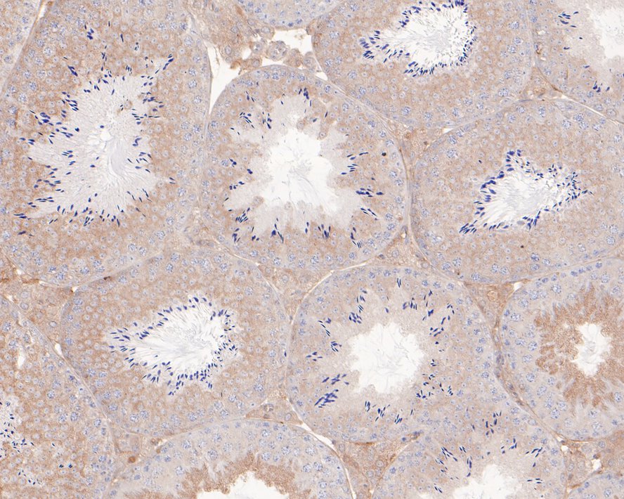 Immunohistochemical analysis of paraffin-embedded mouse testis tissue with Rabbit anti-NFkB p100 antibody (ET1705-45) at 1/50 dilution.<br />
<br />
The section was pre-treated using heat mediated antigen retrieval with sodium citrate buffer (pH 6.0) for 2 minutes. The tissues were blocked in 1% BSA for 20 minutes at room temperature, washed with ddH2O and PBS, and then probed with the primary antibody (ET1705-45) at 1/50 dilution for 1 hour at room temperature. The detection was performed using an HRP conjugated compact polymer system. DAB was used as the chromogen. Tissues were counterstained with hematoxylin and mounted with DPX.