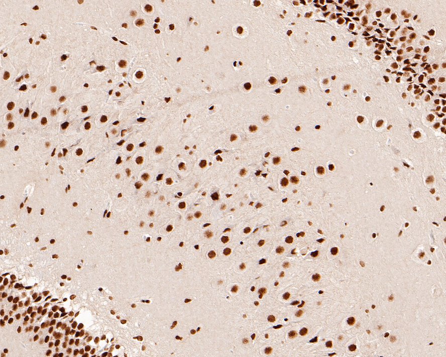 Immunohistochemical analysis of paraffin-embedded rat hippocampus tissue with Rabbit anti-NRF1 antibody (ET1705-86) at 1/1,000 dilution.<br />
<br />
The section was pre-treated using heat mediated antigen retrieval with sodium citrate buffer (pH 6.0) for 2 minutes. The tissues were blocked in 1% BSA for 20 minutes at room temperature, washed with ddH2O and PBS, and then probed with the primary antibody (ET1705-86) at 1/1,000 dilution for 1 hour at room temperature. The detection was performed using an HRP conjugated compact polymer system. DAB was used as the chromogen. Tissues were counterstained with hematoxylin and mounted with DPX.