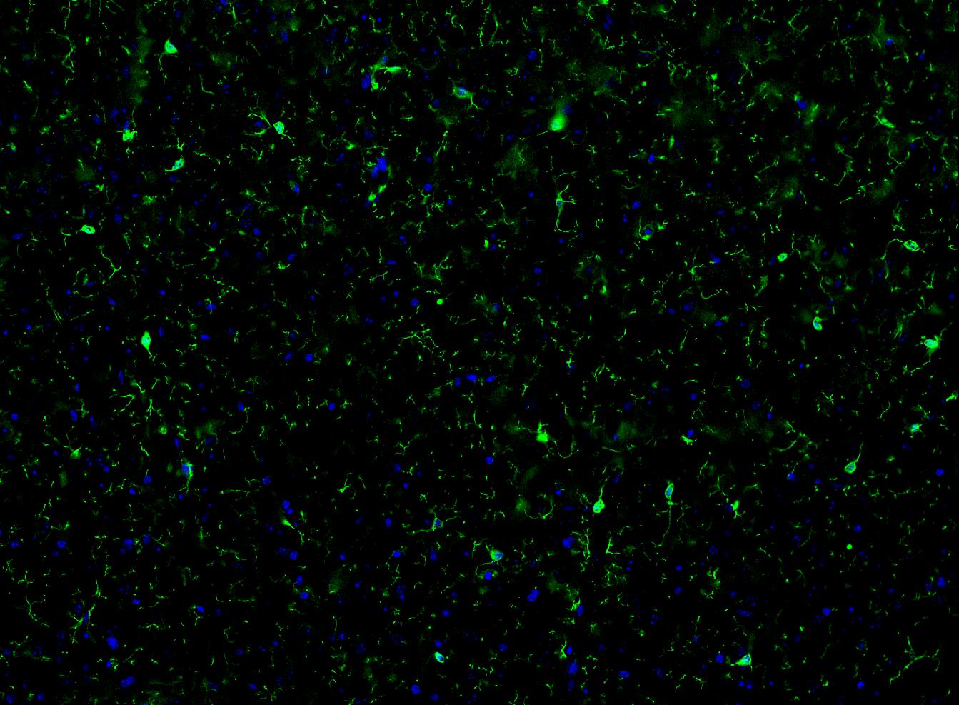 Immunofluorescence analysis of paraffin-embedded rat brain tissue labeling Iba1 with Rabbit anti-Iba1 antibody (ET1705-78) at 1/100 dilution.<br />
<br />
The section was pre-treated using heat mediated antigen retrieval with Tris-EDTA buffer (pH 9.0) for 20 minutes. The tissues were blocked in 10% negative goat serum for 1 hour at room temperature, washed with PBS, and then probed with the primary antibody (ET1705-78, green) at 1/100 dilution overnight at 4 ℃, washed with PBS.<br />
<br />
Goat Anti-Rabbit IgG H&L (iFluor™ 488, HA1121) was used as the secondary antibody at 1/1,000 dilution. Nuclei were counterstained with DAPI (blue).