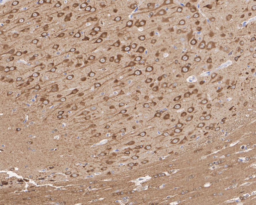 Immunohistochemical analysis of paraffin-embedded rat brain tissue with Rabbit anti-Phospho-Tau(T231) antibody (ET1610-31) at 1/800 dilution.<br />
<br />
The section was pre-treated using heat mediated antigen retrieval with Tris-EDTA buffer (pH 9.0) for 20 minutes. The tissues were blocked in 1% BSA for 20 minutes at room temperature, washed with ddH2O and PBS, and then probed with the primary antibody (ET1610-31) at 1/800 dilution for 1 hour at room temperature. The detection was performed using an HRP conjugated compact polymer system. DAB was used as the chromogen. Tissues were counterstained with hematoxylin and mounted with DPX.