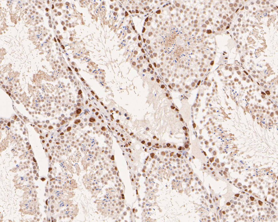 Immunohistochemical analysis of paraffin-embedded mouse testis tissue with Rabbit anti-Islet 1 antibody (ET1610-33) at 1/200 dilution.<br />
<br />
The section was pre-treated using heat mediated antigen retrieval with sodium citrate buffer (pH 6.0) for 2 minutes. The tissues were blocked in 1% BSA for 20 minutes at room temperature, washed with ddH2O and PBS, and then probed with the primary antibody (ET1610-33) at 1/200 dilution for 1 hour at room temperature. The detection was performed using an HRP conjugated compact polymer system. DAB was used as the chromogen. Tissues were counterstained with hematoxylin and mounted with DPX.