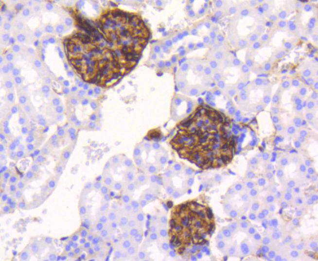 Immunohistochemical analysis of paraffin-embedded human kidney tissue with Rabbit anti-Vimentin antibody (ET1610-39) at 1/5,000 dilution.<br />
<br />
The section was pre-treated using heat mediated antigen retrieval with Tris-EDTA buffer (pH 9.0) for 20 minutes. The tissues were blocked in 1% BSA for 20 minutes at room temperature, washed with ddH2O and PBS, and then probed with the primary antibody (ET1610-39) at 1/5,000 dilution for 1 hour at room temperature. The detection was performed using an HRP conjugated compact polymer system. DAB was used as the chromogen. Tissues were counterstained with hematoxylin and mounted with DPX.