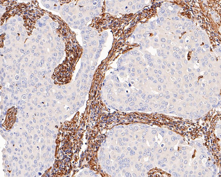 Immunohistochemical analysis of paraffin-embedded mouse large intestine tissue with Rabbit anti-Vimentin antibody (ET1610-39) at 1/500 dilution.<br />
<br />
The section was pre-treated using heat mediated antigen retrieval with Tris-EDTA buffer (pH 9.0) for 20 minutes. The tissues were blocked in 1% BSA for 20 minutes at room temperature, washed with ddH2O and PBS, and then probed with the primary antibody (ET1610-39) at 1/500 dilution for 1 hour at room temperature. The detection was performed using an HRP conjugated compact polymer system. DAB was used as the chromogen. Tissues were counterstained with hematoxylin and mounted with DPX.