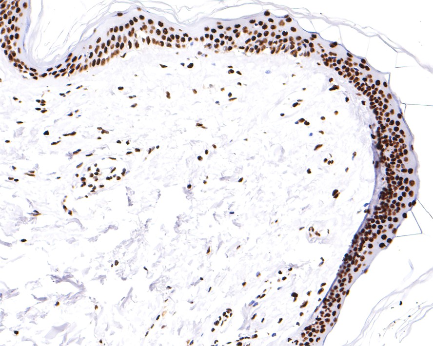 Immunohistochemical analysis of paraffin-embedded human skin tissue with Rabbit anti-hnRNP U antibody (ET7107-10) at 1/200 dilution.<br />
<br />
The section was pre-treated using heat mediated antigen retrieval with sodium citrate buffer (pH 6.0) for 2 minutes. The tissues were blocked in 1% BSA for 20 minutes at room temperature, washed with ddH2O and PBS, and then probed with the primary antibody (ET7107-10) at 1/200 dilution for 1 hour at room temperature. The detection was performed using an HRP conjugated compact polymer system. DAB was used as the chromogen. Tissues were counterstained with hematoxylin and mounted with DPX.