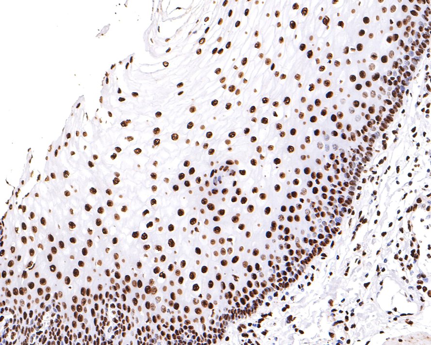 Immunohistochemical analysis of paraffin-embedded human esophagus tissue with Rabbit anti-hnRNP U antibody (ET7107-10) at 1/200 dilution.<br />
<br />
The section was pre-treated using heat mediated antigen retrieval with sodium citrate buffer (pH 6.0) for 2 minutes. The tissues were blocked in 1% BSA for 20 minutes at room temperature, washed with ddH2O and PBS, and then probed with the primary antibody (ET7107-10) at 1/200 dilution for 1 hour at room temperature. The detection was performed using an HRP conjugated compact polymer system. DAB was used as the chromogen. Tissues were counterstained with hematoxylin and mounted with DPX.