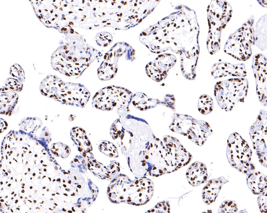 Immunohistochemical analysis of paraffin-embedded human placenta tissue with Rabbit anti-hnRNP U antibody (ET7107-10) at 1/200 dilution.<br />
<br />
The section was pre-treated using heat mediated antigen retrieval with sodium citrate buffer (pH 6.0) for 2 minutes. The tissues were blocked in 1% BSA for 20 minutes at room temperature, washed with ddH2O and PBS, and then probed with the primary antibody (ET7107-10) at 1/200 dilution for 1 hour at room temperature. The detection was performed using an HRP conjugated compact polymer system. DAB was used as the chromogen. Tissues were counterstained with hematoxylin and mounted with DPX.