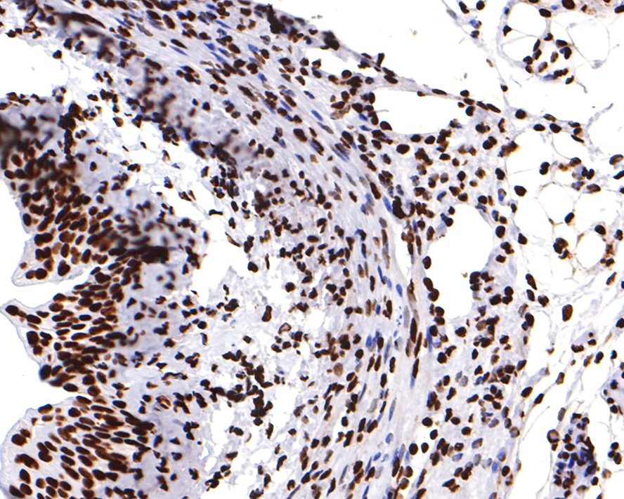 Immunohistochemical analysis of paraffin-embedded mouse bladder tissue with Rabbit anti-hnRNP U antibody (ET7107-10) at 1/400 dilution.<br />
<br />
The section was pre-treated using heat mediated antigen retrieval with sodium citrate buffer (pH 6.0) for 2 minutes. The tissues were blocked in 1% BSA for 20 minutes at room temperature, washed with ddH2O and PBS, and then probed with the primary antibody (ET7107-10) at 1/400 dilution for 1 hour at room temperature. The detection was performed using an HRP conjugated compact polymer system. DAB was used as the chromogen. Tissues were counterstained with hematoxylin and mounted with DPX.