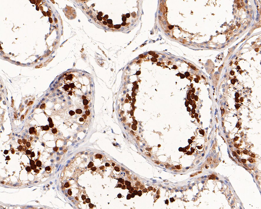 Immunohistochemical analysis of paraffin-embedded human testis tissue with Rabbit anti-Securin antibody (ET7107-50) at 1/1,000 dilution.<br />
<br />
The section was pre-treated using heat mediated antigen retrieval with sodium citrate buffer (pH 6.0) for 2 minutes. The tissues were blocked in 1% BSA for 20 minutes at room temperature, washed with ddH2O and PBS, and then probed with the primary antibody (ET7107-50) at 1/1,000 dilution for 1 hour at room temperature. The detection was performed using an HRP conjugated compact polymer system. DAB was used as the chromogen. Tissues were counterstained with hematoxylin and mounted with DPX.