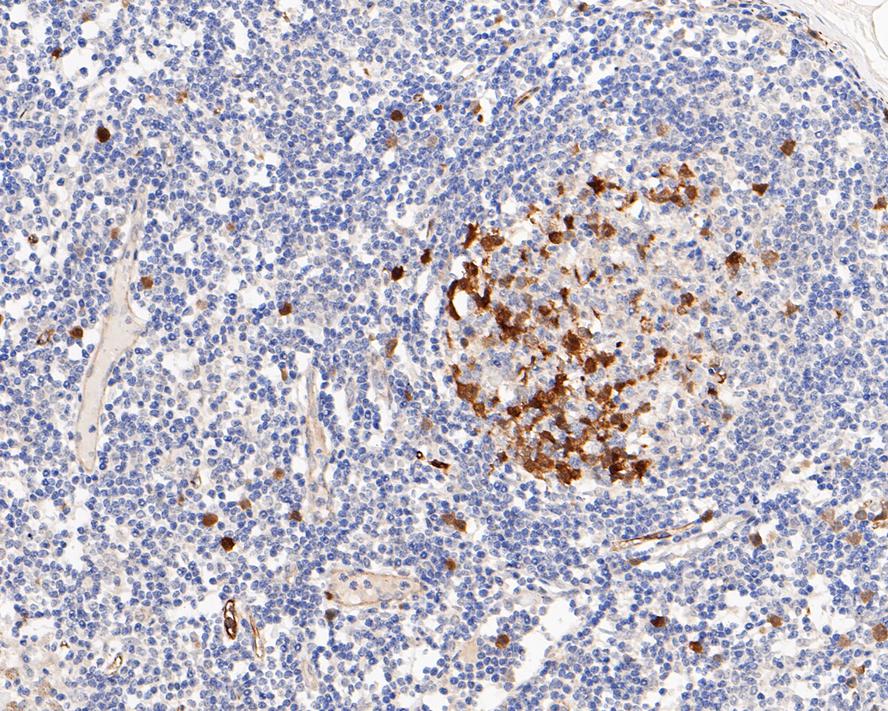 Immunohistochemical analysis of paraffin-embedded human lymph nodes tissue with Rabbit anti-Securin antibody (ET7107-50) at 1/1,000 dilution.<br />
<br />
The section was pre-treated using heat mediated antigen retrieval with sodium citrate buffer (pH 6.0) for 2 minutes. The tissues were blocked in 1% BSA for 20 minutes at room temperature, washed with ddH2O and PBS, and then probed with the primary antibody (ET7107-50) at 1/1,000 dilution for 1 hour at room temperature. The detection was performed using an HRP conjugated compact polymer system. DAB was used as the chromogen. Tissues were counterstained with hematoxylin and mounted with DPX.