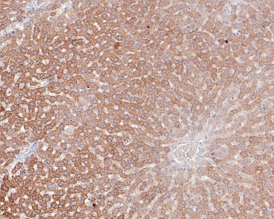Immunohistochemical analysis of paraffin-embedded rat liver tissue with Rabbit anti-CPS1 antibody (ET7107-69) at 1/200 dilution.<br />
<br />
The section was pre-treated using heat mediated antigen retrieval with sodium citrate buffer (pH 6.0) for 2 minutes. The tissues were blocked in 1% BSA for 2 minutes at room temperature, washed with ddH2O and PBS, and then probed with the primary antibody (ET7107-69) at 1/200 dilution for 1 hour at room temperature. The detection was performed using an HRP conjugated compact polymer system. DAB was used as the chromogen. Tissues were counterstained with hematoxylin and mounted with DPX.