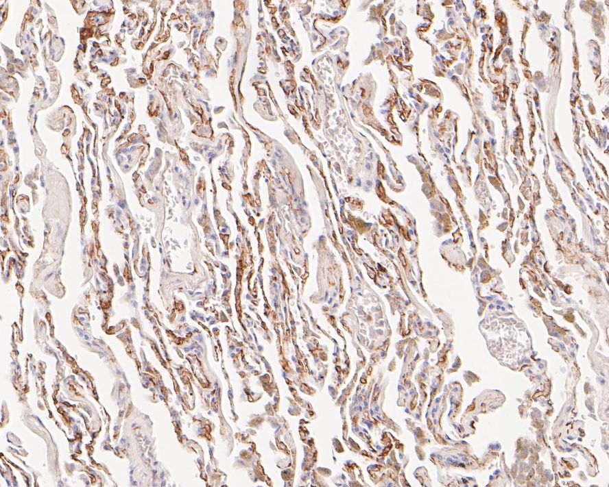 Immunohistochemical analysis of paraffin-embedded human lung tissue with Rabbit anti-Thrombomodulin antibody (ET7107-92) at 1/50 dilution.<br />
<br />
The section was pre-treated using heat mediated antigen retrieval with Tris-EDTA buffer (pH 9.0) for 20 minutes. The tissues were blocked in 1% BSA for 20 minutes at room temperature, washed with ddH2O and PBS, and then probed with the primary antibody (ET7107-92) at 1/50 dilution for 1 hour at room temperature. The detection was performed using an HRP conjugated compact polymer system. DAB was used as the chromogen. Tissues were counterstained with hematoxylin and mounted with DPX.