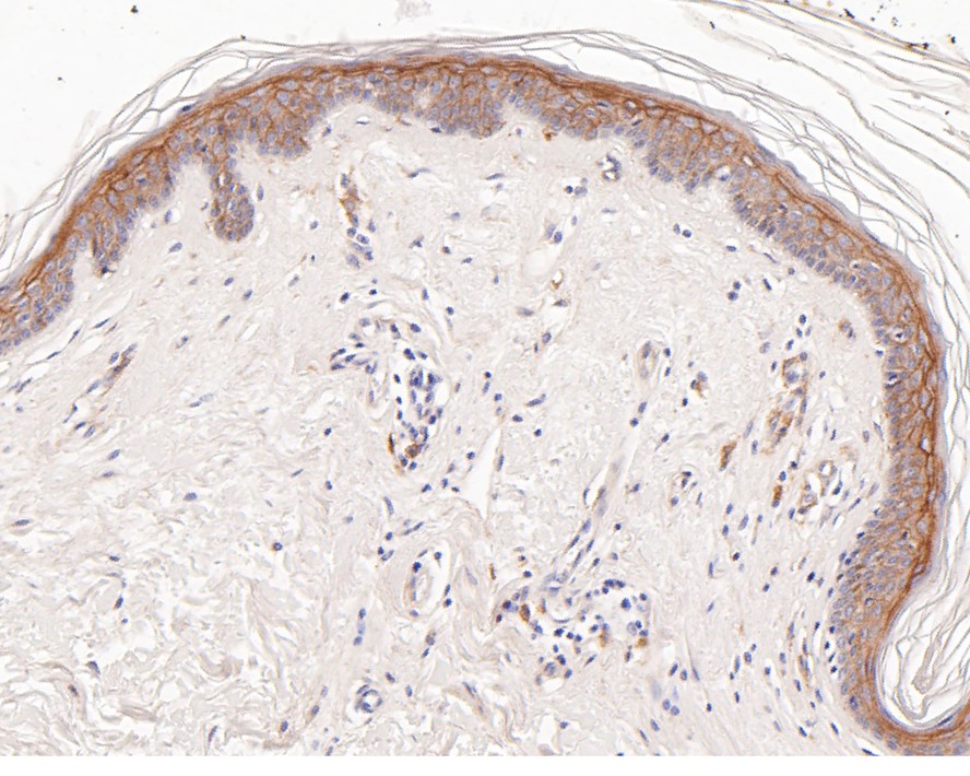 Immunohistochemical analysis of paraffin-embedded human skin tissue with Rabbit anti-Thrombomodulin antibody (ET7107-92) at 1/200 dilution.<br />
<br />
The section was pre-treated using heat mediated antigen retrieval with Tris-EDTA buffer (pH 9.0) for 20 minutes. The tissues were blocked in 1% BSA for 20 minutes at room temperature, washed with ddH2O and PBS, and then probed with the primary antibody (ET7107-92) at 1/200 dilution for 1 hour at room temperature. The detection was performed using an HRP conjugated compact polymer system. DAB was used as the chromogen. Tissues were counterstained with hematoxylin and mounted with DPX.
