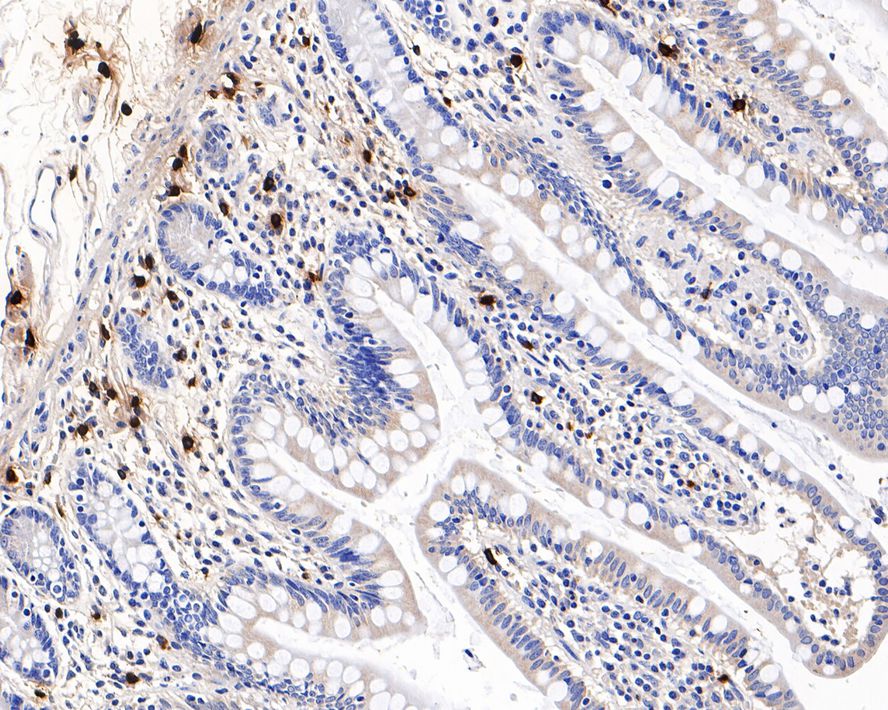 Immunohistochemical analysis of paraffin-embedded human small intestine tissue with Rabbit anti-Mast Cell Chymase antibody (ET7107-19) at 1/800 dilution.<br />
<br />
The section was pre-treated using heat mediated antigen retrieval with Tris-EDTA buffer (pH 9.0) for 20 minutes. The tissues were blocked in 1% BSA for 20 minutes at room temperature, washed with ddH2O and PBS, and then probed with the primary antibody (ET7107-19) at 1/800 dilution for 1 hour at room temperature. The detection was performed using an HRP conjugated compact polymer system. DAB was used as the chromogen. Tissues were counterstained with hematoxylin and mounted with DPX.