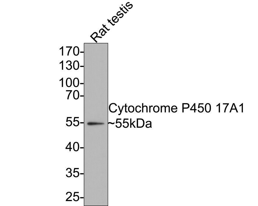 Western blot analysis of Cytochrome P450 17A1 on rat testis tissue lysates with Rabbit anti-Cytochrome P450 17A1 antibody (ET7107-61) at 1/500 dilution.<br />
<br />
Lysates/proteins at 20 µg/Lane.<br />
<br />
Predicted band size: 57 kDa<br />
Observed band size: 55 kDa<br />
<br />
Exposure time: 2 minutes;<br />
<br />
10% SDS-PAGE gel.<br />
<br />
Proteins were transferred to a PVDF membrane and blocked with 5% NFDM/TBST for 1 hour at room temperature. The primary antibody (ET7107-61) at 1/500 dilution was used in 5% NFDM/TBST at room temperature for 2 hours. Goat Anti-Rabbit IgG - HRP Secondary Antibody (HA1001) at 1:300,000 dilution was used for 1 hour at room temperature.