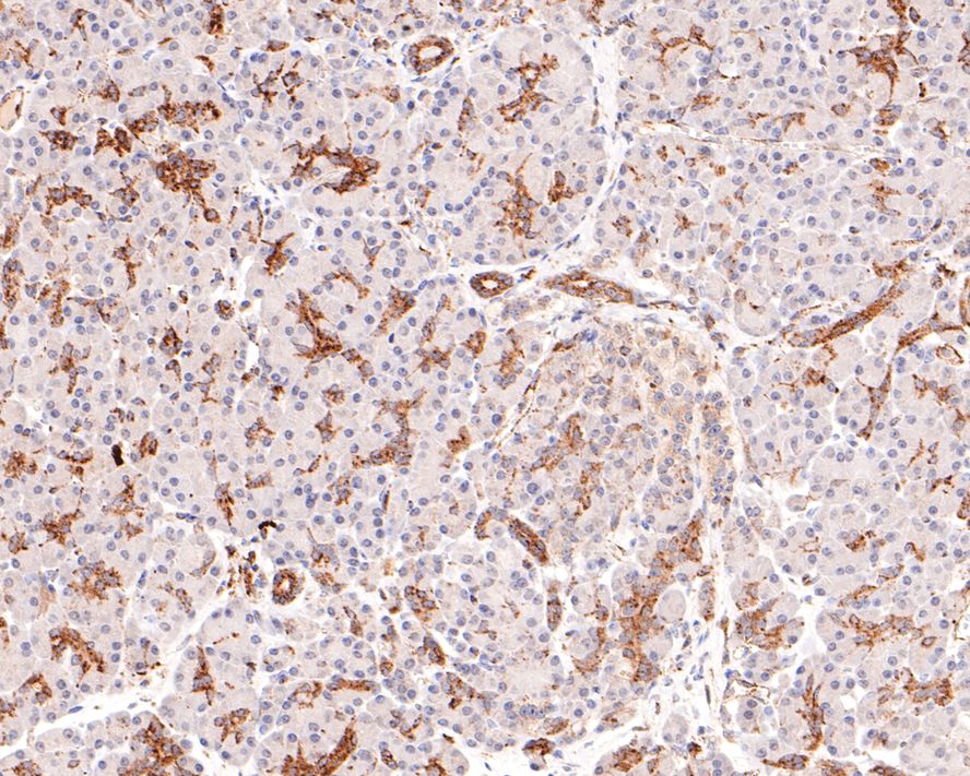Immunohistochemical analysis of paraffin-embedded human pancreas tissue with Rabbit anti-Dcp1a antibody (ET7107-26) at 1/400 dilution.<br />
<br />
The section was pre-treated using heat mediated antigen retrieval with sodium citrate buffer (pH 6.0) for 2 minutes. The tissues were blocked in 1% BSA for 20 minutes at room temperature, washed with ddH2O and PBS, and then probed with the primary antibody (ET7107-26) at 1/400 dilution for 1 hour at room temperature. The detection was performed using an HRP conjugated compact polymer system. DAB was used as the chromogen. Tissues were counterstained with hematoxylin and mounted with DPX.