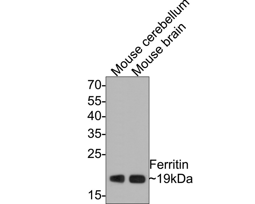 Western blot analysis of Ferritin on different lysates with Rabbit anti-Ferritin antibody (ET1610-78) at 1/500 dilution.<br />
<br />
Lane 1: Mouse cerebellum tissue lysate<br />
Lane 2: Mouse brain tissue lysate<br />
<br />
Lysates/proteins at 20 µg/Lane.<br />
<br />
Predicted band size: 21 kDa<br />
Observed band size: 19 kDa<br />
<br />
Exposure time: 1 minute;<br />
<br />
12% SDS-PAGE gel.<br />
<br />
Proteins were transferred to a PVDF membrane and blocked with 5% NFDM/TBST for 1 hour at room temperature. The primary antibody (ET1610-78) at 1/500 dilution was used in 5% NFDM/TBST at room temperature for 2 hours. Goat Anti-Rabbit IgG - HRP Secondary Antibody (HA1001) at 1:300,000 dilution was used for 1 hour at room temperature.