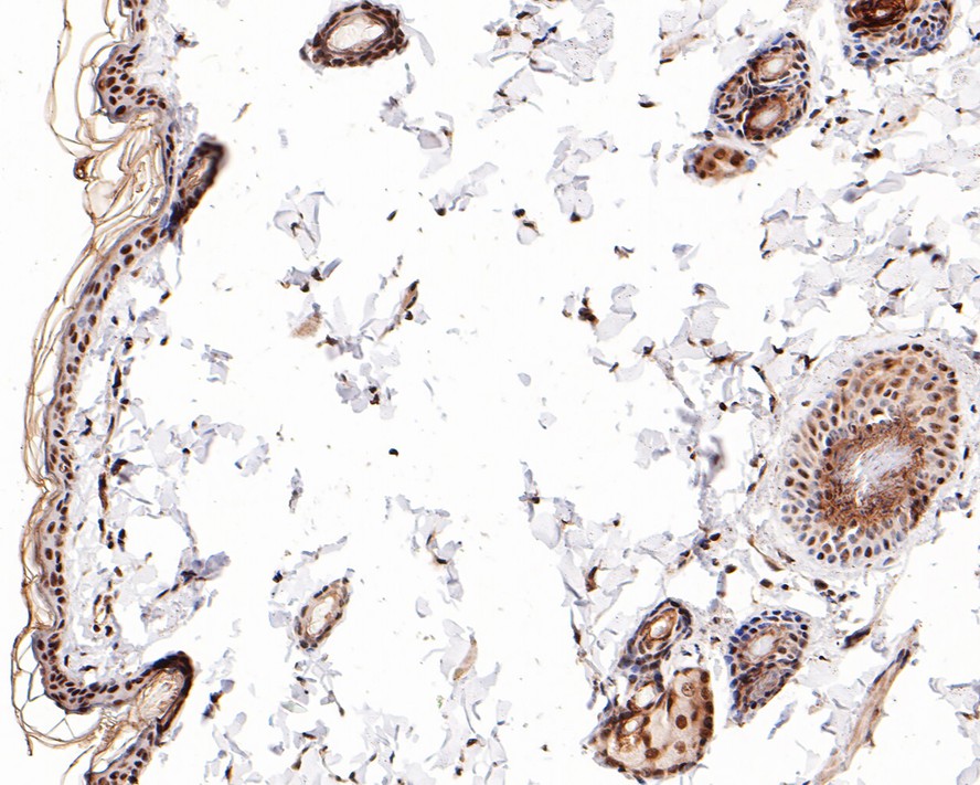 Immunohistochemical analysis of paraffin-embedded rat skin tissue with Rabbit anti-eIF4A3 antibody (ET7108-11) at 1/800 dilution.<br />
<br />
The section was pre-treated using heat mediated antigen retrieval with sodium citrate buffer (pH 6.0) for 2 minutes. The tissues were blocked in 1% BSA for 20 minutes at room temperature, washed with ddH2O and PBS, and then probed with the primary antibody (ET7108-11) at 1/800 dilution for 1 hour at room temperature. The detection was performed using an HRP conjugated compact polymer system. DAB was used as the chromogen. Tissues were counterstained with hematoxylin and mounted with DPX.