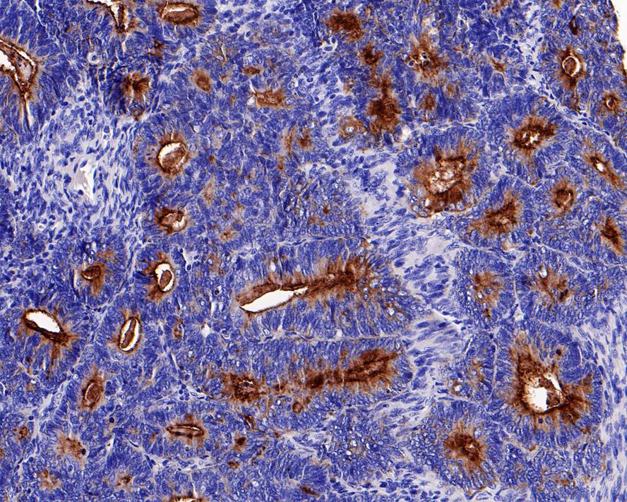 Immunohistochemical analysis of paraffin-embedded human kidney tissue with Rabbit anti-MUC1 antibody (ET1611-14) at 1/1,000 dilution.<br />
<br />
The section was pre-treated using heat mediated antigen retrieval with Tris-EDTA buffer (pH 9.0) for 20 minutes. The tissues were blocked in 1% BSA for 20 minutes at room temperature, washed with ddH2O and PBS, and then probed with the primary antibody (ET1611-14) at 1/1,000 dilution for 1 hour at room temperature. The detection was performed using an HRP conjugated compact polymer system. DAB was used as the chromogen. Tissues were counterstained with hematoxylin and mounted with DPX.