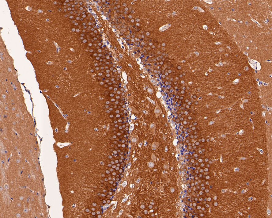 Immunohistochemical analysis of paraffin-embedded mouse hippocampus tissue with Rabbit anti-MEK1/2 antibody (ET1602-3) at 1/1,000 dilution.<br />
<br />
The section was pre-treated using heat mediated antigen retrieval with Tris-EDTA buffer (pH 9.0) for 20 minutes. The tissues were blocked in 1% BSA for 20 minutes at room temperature, washed with ddH2O and PBS, and then probed with the primary antibody (ET1602-3) at 1/1,000 dilution for 1 hour at room temperature. The detection was performed using an HRP conjugated compact polymer system. DAB was used as the chromogen. Tissues were counterstained with hematoxylin and mounted with DPX.
