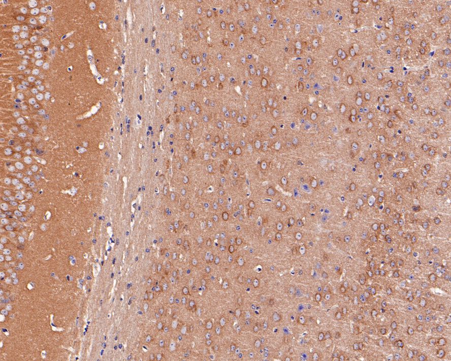 Immunohistochemical analysis of paraffin-embedded mouse brain tissue with Rabbit anti-MEK1/2 antibody (ET1602-3) at 1/1,000 dilution.<br />
<br />
The section was pre-treated using heat mediated antigen retrieval with Tris-EDTA buffer (pH 9.0) for 20 minutes. The tissues were blocked in 1% BSA for 20 minutes at room temperature, washed with ddH2O and PBS, and then probed with the primary antibody (ET1602-3) at 1/1,000 dilution for 1 hour at room temperature. The detection was performed using an HRP conjugated compact polymer system. DAB was used as the chromogen. Tissues were counterstained with hematoxylin and mounted with DPX.