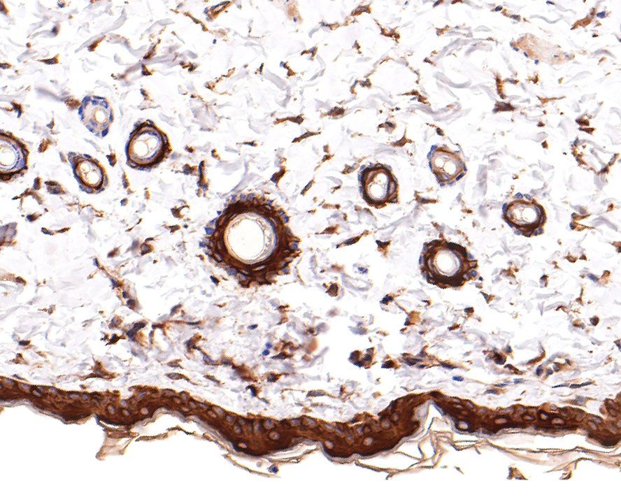 Immunohistochemical analysis of paraffin-embedded rat skin tissue with Rabbit anti-Cytokeratin 1 antibody (ET1611-46) at 1/400 dilution.<br />
<br />
The section was pre-treated using heat mediated antigen retrieval with Tris-EDTA buffer (pH 9.0) for 20 minutes. The tissues were blocked in 1% BSA for 20 minutes at room temperature, washed with ddH2O and PBS, and then probed with the primary antibody (ET1611-46) at 1/400 dilution for 1 hour at room temperature. The detection was performed using an HRP conjugated compact polymer system. DAB was used as the chromogen. Tissues were counterstained with hematoxylin and mounted with DPX.