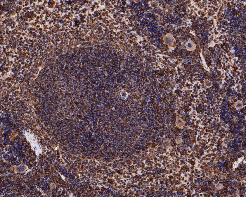 Immunohistochemical analysis of paraffin-embedded mouse spleen tissue with Rabbit anti-Caspase-9 antibody (ET1603-27) at 1/400 dilution.<br />
<br />
The section was pre-treated using heat mediated antigen retrieval with sodium citrate buffer (pH 6.0) for 2 minutes. The tissues were blocked in 1% BSA for 20 minutes at room temperature, washed with ddH2O and PBS, and then probed with the primary antibody (ET1603-27) at 1/400 dilution for 1 hour at room temperature. The detection was performed using an HRP conjugated compact polymer system. DAB was used as the chromogen. Tissues were counterstained with hematoxylin and mounted with DPX.