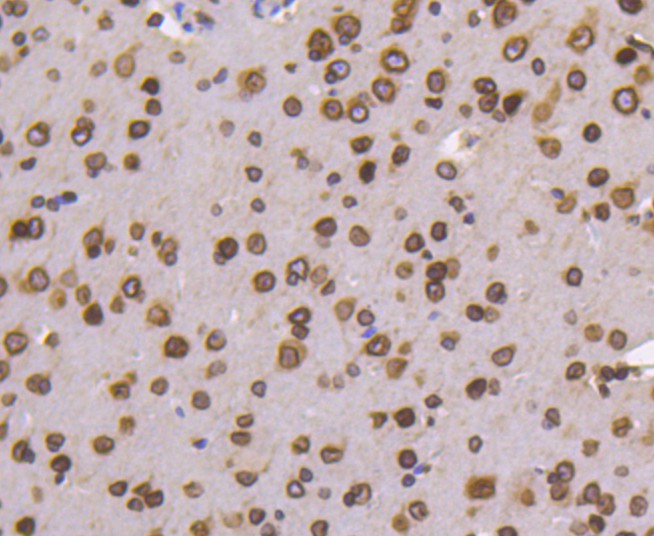 Immunohistochemical analysis of paraffin-embedded mouse brain tissue using anti-Lamin B1 antibody. The section was pre-treated using heat mediated antigen retrieval with Tris-EDTA buffer (pH 8.0-8.4) for 20 minutes.The tissues were blocked in 5% BSA for 30 minutes at room temperature, washed with ddH2O and PBS, and then probed with the primary antibody (ET1606-27, 1/50) for 30 minutes at room temperature. The detection was performed using an HRP conjugated compact polymer system. DAB was used as the chromogen. Tissues were counterstained with hematoxylin and mounted with DPX.
