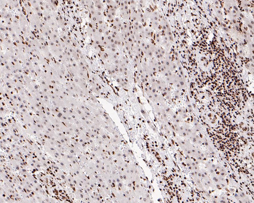 Immunohistochemical analysis of paraffin-embedded human liver  tissue with Rabbit anti-Histone H2A.Z antibody (ET1609-23) at 1/200 dilution.<br />
<br />
The section was pre-treated using heat mediated antigen retrieval with sodium citrate buffer (pH 6.0) for 2 minutes. The tissues were blocked in 1% BSA for 20 minutes at room temperature, washed with ddH2O and PBS, and then probed with the primary antibody (ET1609-23) at 1/200 dilution for 1 hour at room temperature. The detection was performed using an HRP conjugated compact polymer system. DAB was used as the chromogen. Tissues were counterstained with hematoxylin and mounted with DPX.