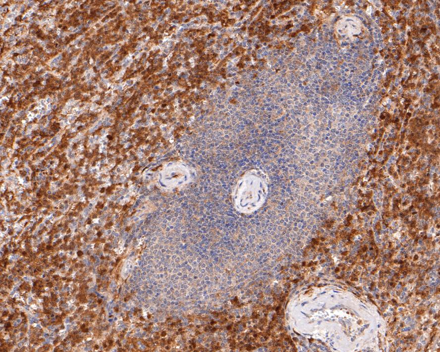 Immunohistochemical analysis of paraffin-embedded human spleen tissue with Rabbit anti-TMS1 antibody (ET1611-62) at 1/400 dilution.<br />
<br />
The section was pre-treated using heat mediated antigen retrieval with Tris-EDTA buffer (pH 9.0) for 20 minutes. The tissues were blocked in 1% BSA for 20 minutes at room temperature, washed with ddH2O and PBS, and then probed with the primary antibody (ET1611-62) at 1/400 dilution for 1 hour at room temperature. The detection was performed using an HRP conjugated compact polymer system. DAB was used as the chromogen. Tissues were counterstained with hematoxylin and mounted with DPX.