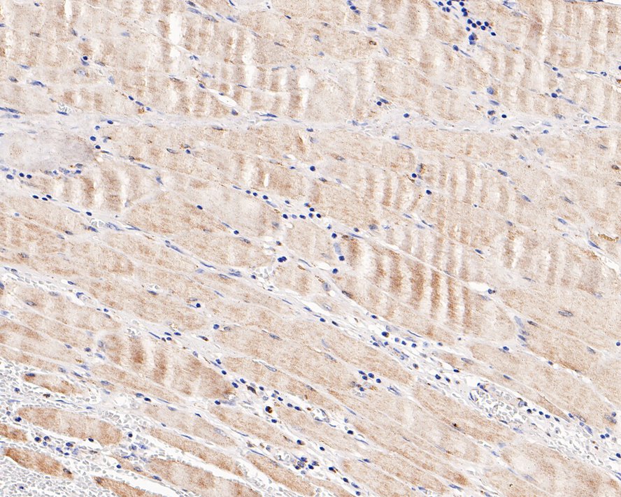 Immunohistochemical analysis of paraffin-embedded human muscle tissue with Rabbit anti-CPT2 antibody (ET1611-64) at 1/1,000 dilution.<br />
<br />
The section was pre-treated using heat mediated antigen retrieval with Tris-EDTA buffer (pH 9.0) for 20 minutes. The tissues were blocked in 1% BSA for 20 minutes at room temperature, washed with ddH2O and PBS, and then probed with the primary antibody (ET1611-64) at 1/1,000 dilution for 1 hour at room temperature. The detection was performed using an HRP conjugated compact polymer system. DAB was used as the chromogen. Tissues were counterstained with hematoxylin and mounted with DPX.