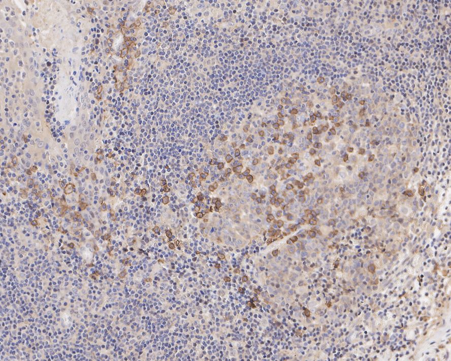 Immunohistochemical analysis of paraffin-embedded human kidney tissue using anti-CD38 antibody. The section was pre-treated using heat mediated antigen retrieval with Tris-EDTA buffer (pH 8.0-8.4) for 20 minutes.The tissues were blocked in 5% BSA for 30 minutes at room temperature, washed with ddH2O and PBS, and then probed with the primary antibody (ET1611-66, 1/50) for 30 minutes at room temperature. The detection was performed using an HRP conjugated compact polymer system. DAB was used as the chromogen. Tissues were counterstained with hematoxylin and mounted with DPX.