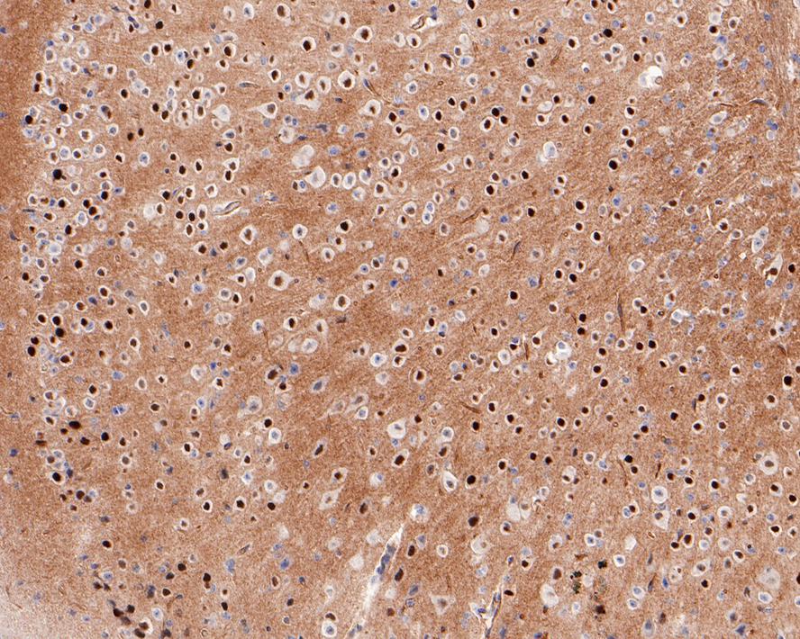Immunohistochemical analysis of paraffin-embedded mouse brain tissue with Rabbit anti-FosB antibody (ET1611-75) at 1/2,000  dilution.<br />
<br />
The section was pre-treated using heat mediated antigen retrieval with sodium citrate buffer (pH 6.0) for 2 minutes. The tissues were blocked in 1% BSA for 20 minutes at room temperature, washed with ddH2O and PBS, and then probed with the primary antibody (ET1611-75) at 1/2,000 dilution for 1 hour at room temperature. The detection was performed using an HRP conjugated compact polymer system. DAB was used as the chromogen. Tissues were counterstained with hematoxylin and mounted with DPX.