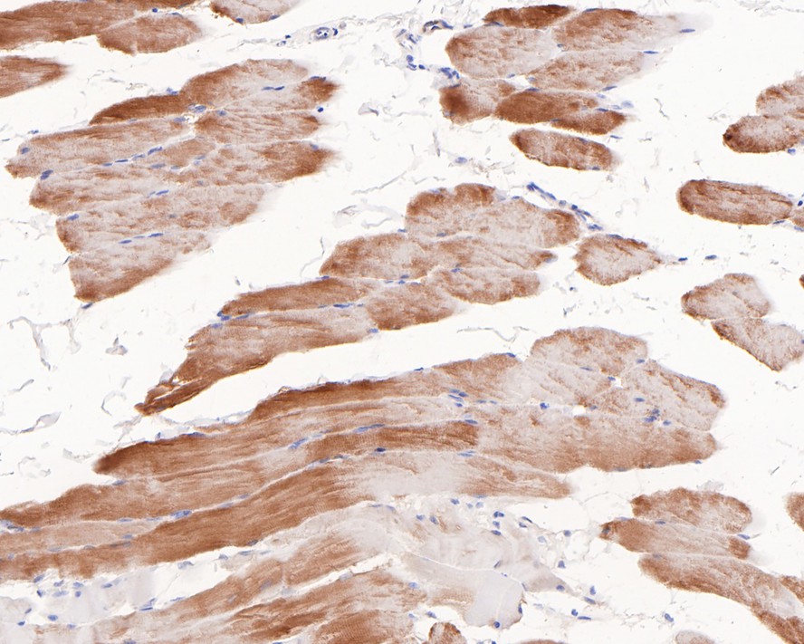 Immunohistochemical analysis of paraffin-embedded rat skeletal muscle tissue with Rabbit anti-Phospho-Glycogen synthase 1(S641) antibody (ET1602-13) at 1/200 dilution.<br />
<br />
The section was pre-treated using heat mediated antigen retrieval with Tris-EDTA buffer (pH 9.0) for 20 minutes. The tissues were blocked in 1% BSA for 20 minutes at room temperature, washed with ddH2O and PBS, and then probed with the primary antibody (ET1602-13) at 1/200 dilution for 1 hour at room temperature. The detection was performed using an HRP conjugated compact polymer system. DAB was used as the chromogen. Tissues were counterstained with hematoxylin and mounted with DPX.