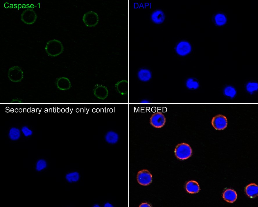 Immunocytochemistry analysis of THP-1 cells labeling Caspase-1 with Rabbit anti-Caspase-1 antibody (ET1608-69) at 1/100 dilution.<br />
<br />
Cells were fixed in 80% precooled methanol for 5 minutes at room temperature, then blocked with 1% BSA in 10% negative goat serum for 1 hour at room temperature. Cells were then incubated with Rabbit anti-Caspase-1 antibody (ET1608-69) at 1/100 dilution in 1% BSA in PBST overnight at 4 ℃. Goat Anti-Rabbit IgG H&L (iFluor™ 488, HA1121) was used as the secondary antibody at 1/1,000 dilution. PBS instead of the primary antibody was used as the secondary antibody only control. Nuclear DNA was labelled in blue with DAPI.<br />
<br />
Beta tubulin (M1305-2, red) was stained at 1/100 dilution overnight at +4℃. Goat Anti-Mouse IgG H&L (iFluor™ 594, HA1126) was used as the secondary antibody at 1/1,000 dilution.