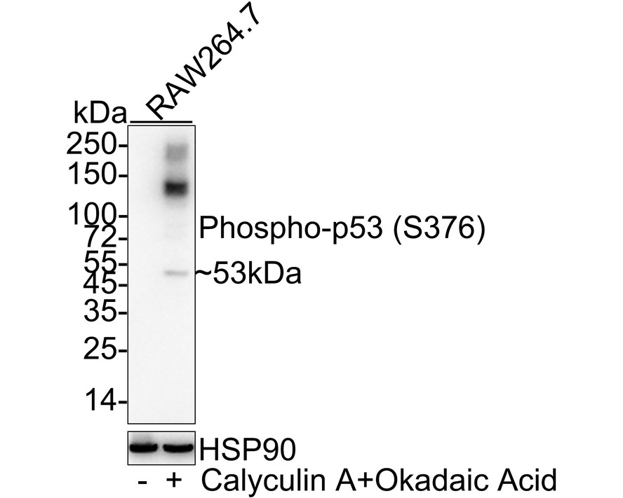 Western blot analysis of Phospho-p53 (S376) on different lysates with Rabbit anti-Phospho-p53 (S376) antibody (ET1609-14) at 1/500 dilution.<br />
<br />
Lane 1: Mouse spleen tissue lysate (20 µg/Lane)<br />
Lane 2: Raw264.7 cell lysate<br />
Lane 3: NIH/3T3 cell lysate<br />
<br />
Lysates/proteins at 10 µg/Lane.<br />
<br />
Predicted band size: 53 kDa<br />
Observed band size: 53 kDa<br />
<br />
Exposure time: 2 minutes;<br />
<br />
10% SDS-PAGE gel.<br />
<br />
Proteins were transferred to a PVDF membrane and blocked with 5% NFDM/TBST for 1 hour at room temperature. The primary antibody (ET1609-14) at 1/500 dilution was used in 5% NFDM/TBST at room temperature for 2 hours. Goat Anti-Rabbit IgG - HRP Secondary Antibody (HA1001) at 1:300,000 dilution was used for 1 hour at room temperature.