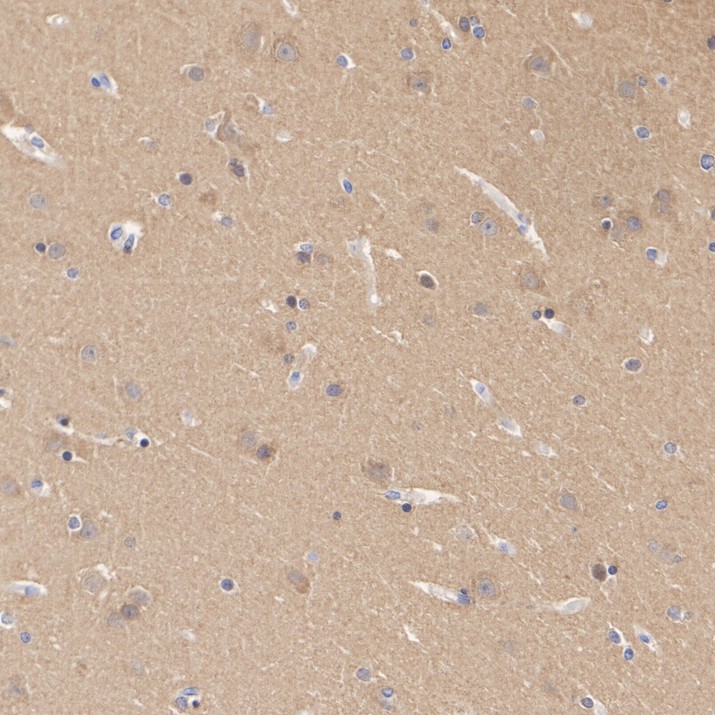 Immunohistochemical analysis of paraffin-embedded rat brain tissue with Rabbit anti-Tau antibody (ET1612-44) at 1/200 dilution.<br />
<br />
The section was pre-treated using heat mediated antigen retrieval with Tris-EDTA buffer (pH 9.0) for 20 minutes. The tissues were blocked in 1% BSA for 20 minutes at room temperature, washed with ddH2O and PBS, and then probed with the primary antibody (ET1612-44) at 1/200 dilution for 1 hour at room temperature. The detection was performed using an HRP conjugated compact polymer system. DAB was used as the chromogen. Tissues were counterstained with hematoxylin and mounted with DPX.
