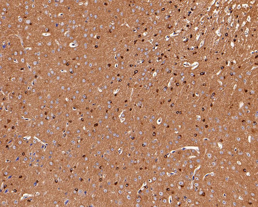 Immunohistochemical analysis of paraffin-embedded mouse brain tissue with Rabbit anti-Tau antibody (ET1612-44) at 1/200 dilution.<br />
<br />
The section was pre-treated using heat mediated antigen retrieval with Tris-EDTA buffer (pH 9.0) for 20 minutes. The tissues were blocked in 1% BSA for 20 minutes at room temperature, washed with ddH2O and PBS, and then probed with the primary antibody (ET1612-44) at 1/200 dilution for 1 hour at room temperature. The detection was performed using an HRP conjugated compact polymer system. DAB was used as the chromogen. Tissues were counterstained with hematoxylin and mounted with DPX.