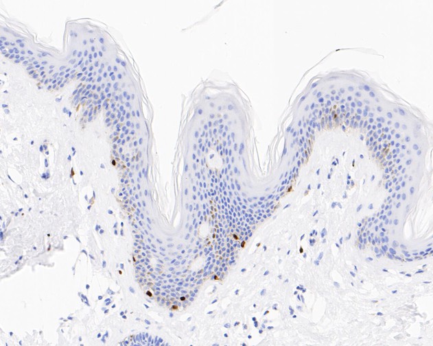 Immunohistochemical analysis of paraffin-embedded rat hippocampus tissue with Rabbit anti-SOX10 antibody (ET1612-79) at 1/800 dilution.<br />
<br />
The section was pre-treated using heat mediated antigen retrieval with sodium citrate buffer (pH 6.0) for 2 minutes. The tissues were blocked in 1% BSA for 20 minutes at room temperature, washed with ddH2O and PBS, and then probed with the primary antibody (ET1612-79) at 1/800 dilution for 1 hour at room temperature. The detection was performed using an HRP conjugated compact polymer system. DAB was used as the chromogen. Tissues were counterstained with hematoxylin and mounted with DPX.