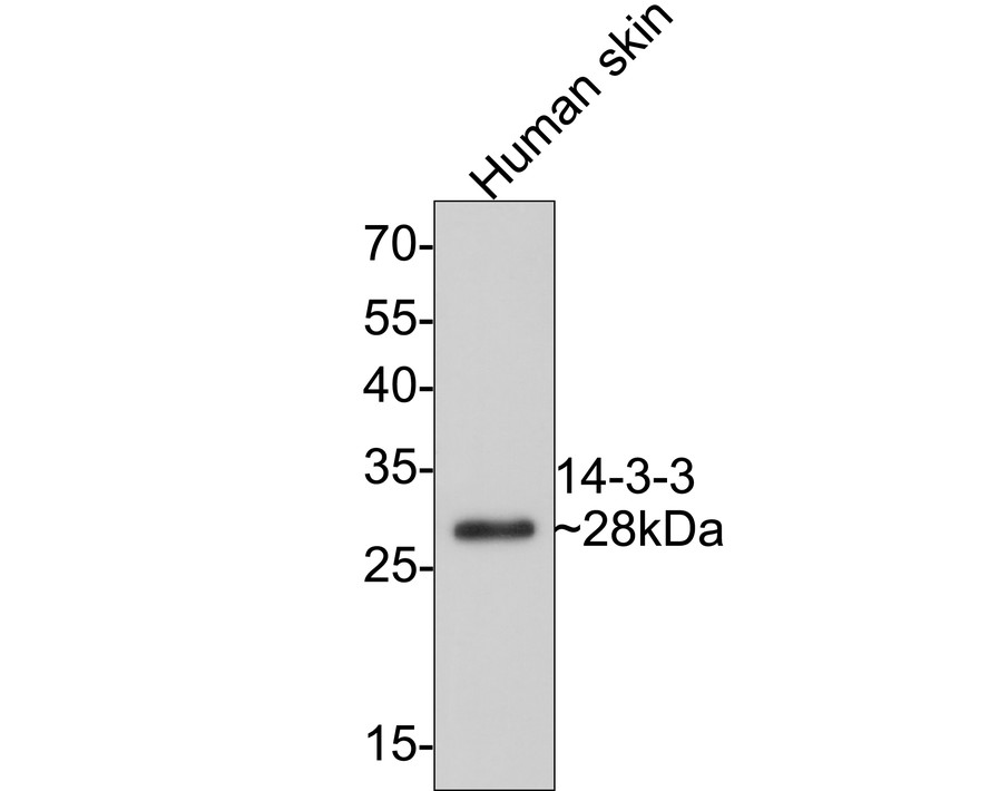 Western blot analysis of 14-3-3 on human skin tissue lysates with Rabbit anti-14-3-3 antibody (ET1701-4) at 1/5,000 dilution.<br />
<br />
Lysates/proteins at 20 µg/Lane.<br />
<br />
Predicted band size: 28 kDa<br />
Observed band size: 28 kDa<br />
<br />
Exposure time: 2 minutes;<br />
<br />
12% SDS-PAGE gel.<br />
<br />
Proteins were transferred to a PVDF membrane and blocked with 5% NFDM/TBST for 1 hour at room temperature. The primary antibody (ET1701-4) at 1/5,000 dilution was used in 5% NFDM/TBST at room temperature for 2 hours. Goat Anti-Rabbit IgG - HRP Secondary Antibody (HA1001) at 1:300,000 dilution was used for 1 hour at room temperature.