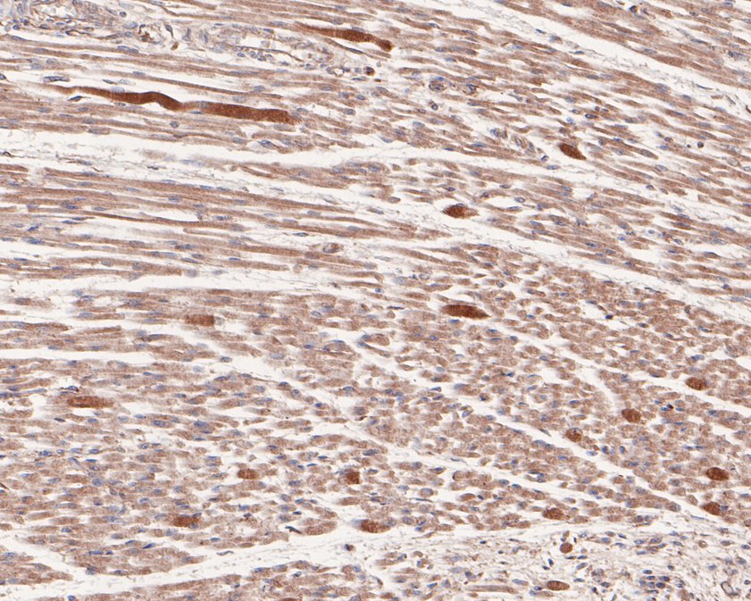 Immunohistochemical analysis of paraffin-embedded human fetal skeletal muscle tissue with Rabbit anti-Phospho-AMPK alpha 2(S345) antibody (ET1701-37) at 1/50 dilution.<br />
<br />
The section was pre-treated using heat mediated antigen retrieval with sodium citrate buffer (pH 6.0) for 2 minutes. The tissues were blocked in 1% BSA for 20 minutes at room temperature, washed with ddH2O and PBS, and then probed with the primary antibody (ET1701-37) at 1/50 dilution for 1 hour at room temperature. The detection was performed using an HRP conjugated compact polymer system. DAB was used as the chromogen. Tissues were counterstained with hematoxylin and mounted with DPX.
