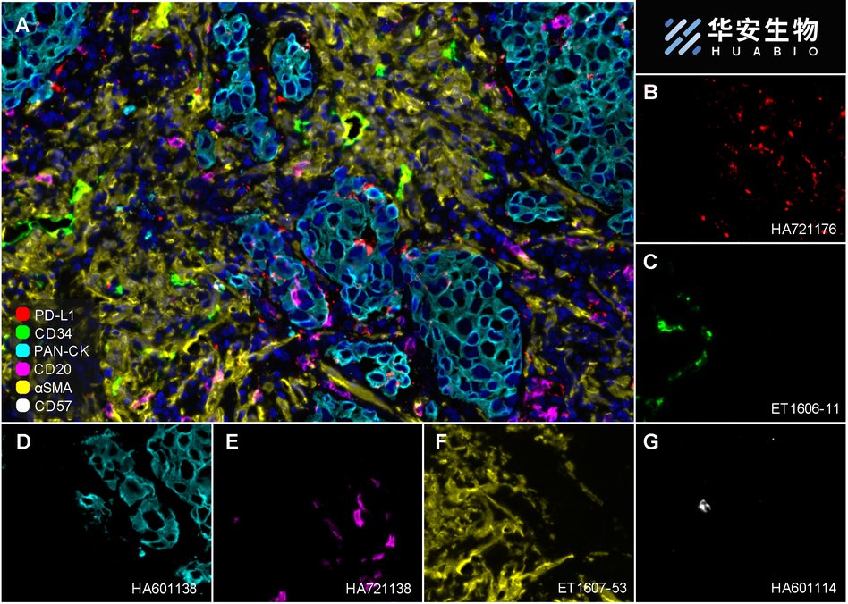 Immunofluorescence analysis of paraffin-embedded human Kidney tissue labeling alpha smooth muscle Actin (ET1607-53).<br />
<br />
The section was pre-treated using heat mediated antigen retrieval with Tris-EDTA buffer (pH 9.0) for 20 minutes. The tissues were blocked in 10% negative goat serum for 1 hour at room temperature, washed with PBS. And then probed with the primary antibody alpha smooth muscle Actin (ET1607-53, red) at 1/1,000 dilution overnight at 4 ℃, washed with PBS.<br />
<br />
iFluor™ 647 conjugate-Goat anti-Rabbit IgG (HA1123) was used as the secondary antibody at 1/1,000 dilution. DAPI was used as nuclear counterstain.