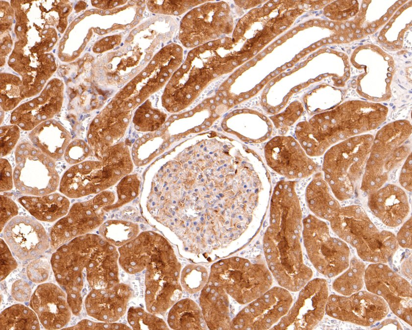 Immunohistochemical analysis of paraffin-embedded human kidney tissue with Rabbit anti-HDAC6 antibody (ET1701-66) at 1/400 dilution.<br />
<br />
The section was pre-treated using heat mediated antigen retrieval with Tris-EDTA buffer (pH 9.0) for 20 minutes. The tissues were blocked in 1% BSA for 20 minutes at room temperature, washed with ddH2O and PBS, and then probed with the primary antibody (ET1701-66) at 1/400 dilution for 1 hour at room temperature. The detection was performed using an HRP conjugated compact polymer system. DAB was used as the chromogen. Tissues were counterstained with hematoxylin and mounted with DPX.