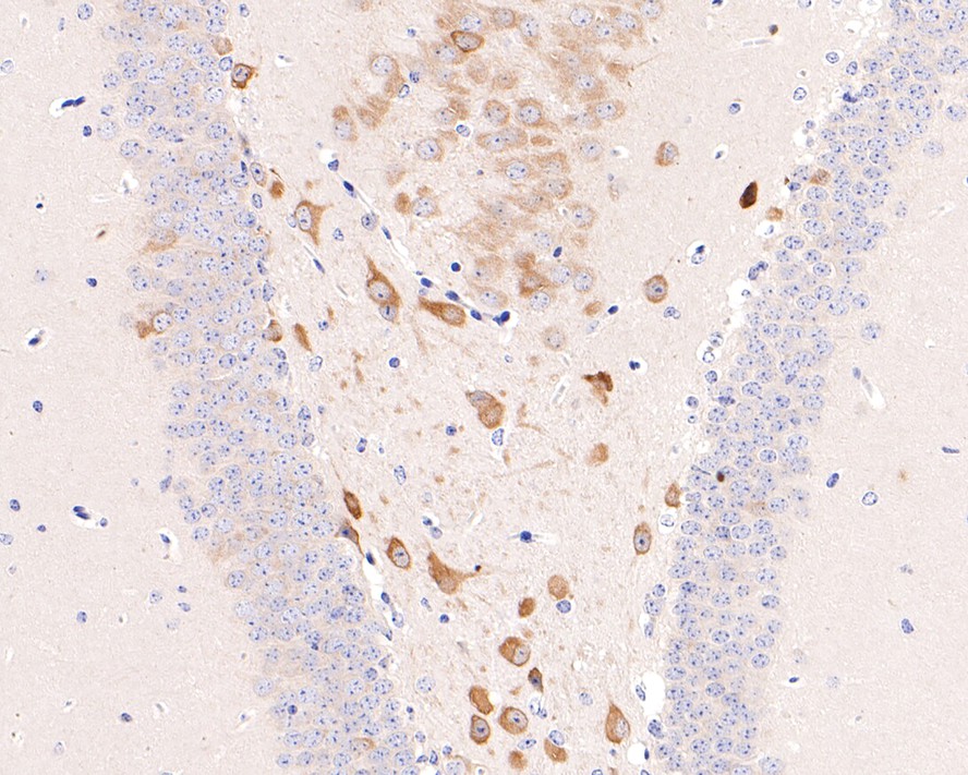 Immunohistochemical analysis of paraffin-embedded mouse hippocampus tissue with Rabbit anti-Phospho-eIF4E (S209) antibody (ET1608-66) at 1/200 dilution.<br />
<br />
The section was pre-treated using heat mediated antigen retrieval with Tris-EDTA buffer (pH 9.0) for 20 minutes. The tissues were blocked in 1% BSA for 20 minutes at room temperature, washed with ddH2O and PBS, and then probed with the primary antibody (ET1608-66) at 1/200 dilution for 1 hour at room temperature. The detection was performed using an HRP conjugated compact polymer system. DAB was used as the chromogen. Tissues were counterstained with hematoxylin and mounted with DPX.