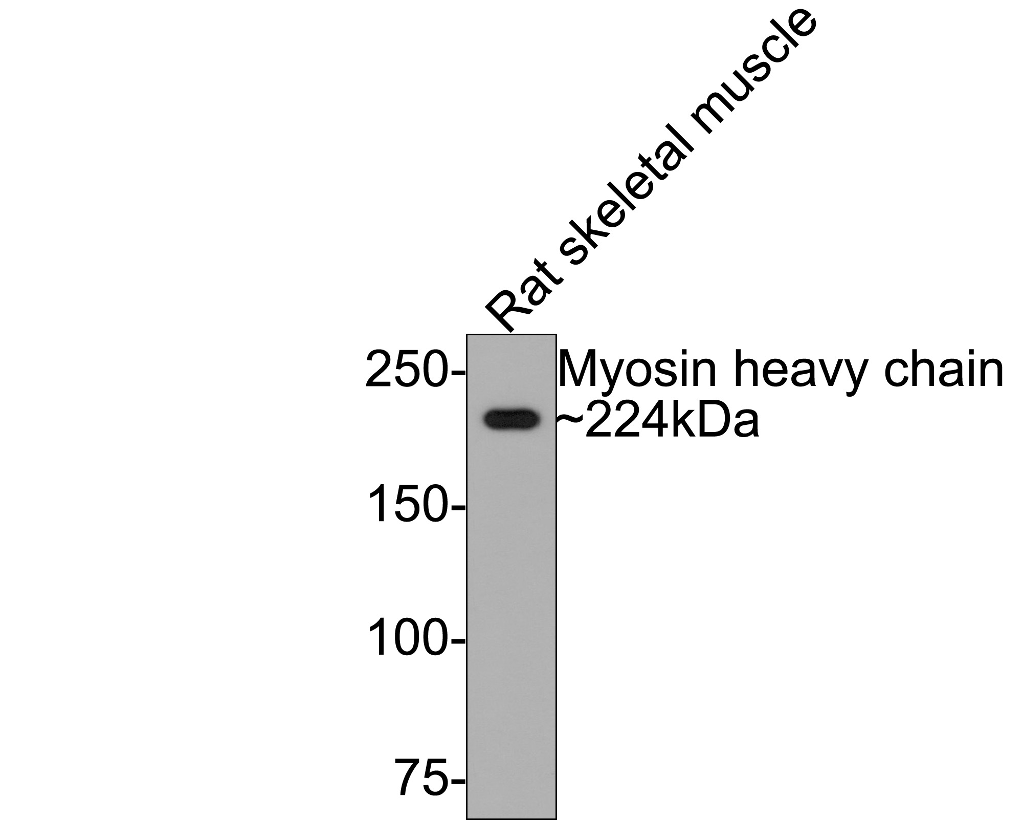 Western blot analysis of Myosin heavy chain on rat skeletal muscle tissue lysates with Rabbit anti-Myosin heavy chain antibody (ET1702-88) at 1/500 dilution.<br />
<br />
Lysates/proteins at 20 µg/Lane.<br />
<br />
Predicted band size: 224 kDa<br />
Observed band size: 224 kDa<br />
<br />
Exposure time: 2 minutes;<br />
<br />
6% SDS-PAGE gel.<br />
<br />
Proteins were transferred to a PVDF membrane and blocked with 5% NFDM/TBST for 1 hour at room temperature. The primary antibody (ET1702-88) at 1/500 dilution was used in 5% NFDM/TBST at room temperature for 2 hours. Goat Anti-Rabbit IgG - HRP Secondary Antibody (HA1001) at 1:300,000 dilution was used for 1 hour at room temperature.