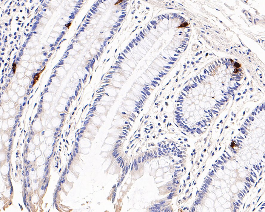 Immunohistochemical analysis of paraffin-embedded human colon tissue with Rabbit anti-Chromogranin A antibody (ET1703-08) at 1/1,000 dilution.<br />
<br />
The section was pre-treated using heat mediated antigen retrieval with Tris-EDTA buffer (pH 9.0) for 20 minutes. The tissues were blocked in 1% BSA for 20 minutes at room temperature, washed with ddH2O and PBS, and then probed with the primary antibody (ET1703-08) at 1/1,000 dilution for 1 hour at room temperature. The detection was performed using an HRP conjugated compact polymer system. DAB was used as the chromogen. Tissues were counterstained with hematoxylin and mounted with DPX.