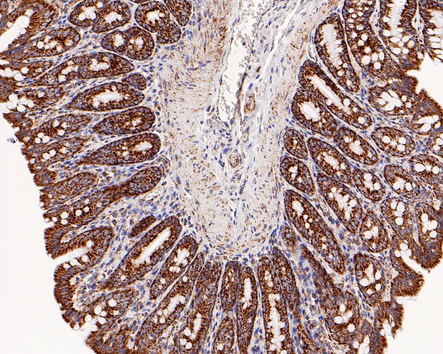 Immunohistochemical analysis of paraffin-embedded rat large intestine tissue with Rabbit anti-TOMM20 antibody (ET1609-25) at 1/800 dilution.<br />
<br />
The section was pre-treated using heat mediated antigen retrieval with Tris-EDTA buffer (pH 9.0) for 20 minutes. The tissues were blocked in 1% BSA for 20 minutes at room temperature, washed with ddH2O and PBS, and then probed with the primary antibody (ET1609-25) at 1/800 dilution for 1 hour at room temperature. The detection was performed using an HRP conjugated compact polymer system. DAB was used as the chromogen. Tissues were counterstained with hematoxylin and mounted with DPX.