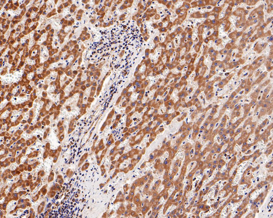 Immunohistochemical analysis of paraffin-embedded human liver tissue with Rabbit anti-TOMM20 antibody (ET1609-25) at 1/800 dilution.<br />
<br />
The section was pre-treated using heat mediated antigen retrieval with Tris-EDTA buffer (pH 9.0) for 20 minutes. The tissues were blocked in 1% BSA for 20 minutes at room temperature, washed with ddH2O and PBS, and then probed with the primary antibody (ET1609-25) at 1/800 dilution for 1 hour at room temperature. The detection was performed using an HRP conjugated compact polymer system. DAB was used as the chromogen. Tissues were counterstained with hematoxylin and mounted with DPX.