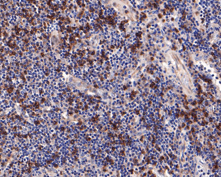 Immunohistochemical analysis of paraffin-embedded human lymph node tissue with Rabbit anti-CD8 alpha antibody (ET1606-31) at 1/100 dilution.<br />
<br />
The section was pre-treated using heat mediated antigen retrieval with Tris-EDTA buffer (pH 9.0) for 20 minutes. The tissues were blocked in 1% BSA for 20 minutes at room temperature, washed with ddH2O and PBS, and then probed with the primary antibody (ET1606-31) at 1/100 dilution for 1 hour at room temperature. The detection was performed using an HRP conjugated compact polymer system. DAB was used as the chromogen. Tissues were counterstained with hematoxylin and mounted with DPX.